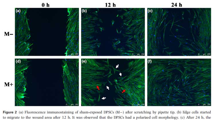 effects of therapeutic magnetic fields for toothache