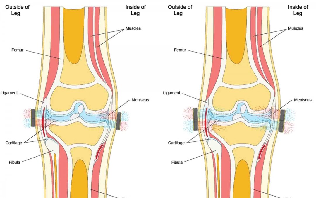 Illustrating magnetic field lines and depth of penetration for magnetic therapy.