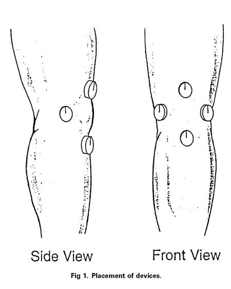 Knee pain treatment with quadrapolar magnets.