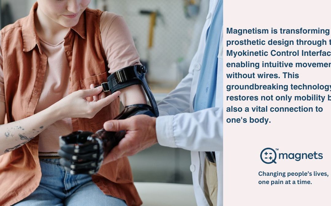 From Magnetism to Movement: The Myokinetic Control Interface in Prosthetic Design