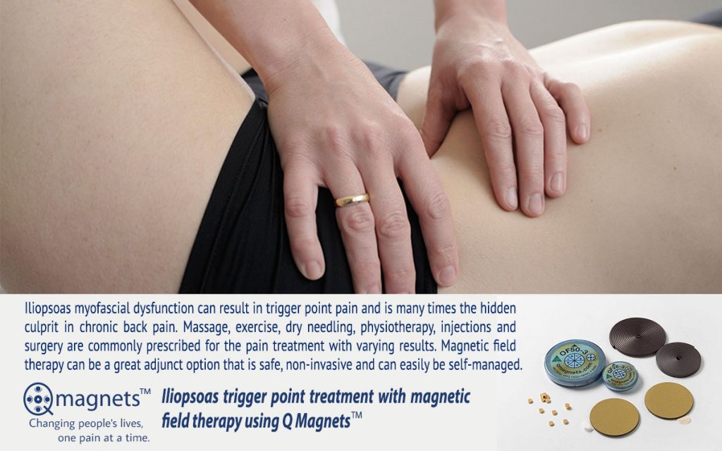 iliopsoas trigger point treatment with magnetic therapy physiotherapist australia uk united states