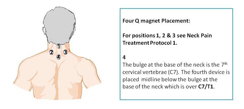 Neck/Shoulder Pain (Severe) - 1 X QF28-3 + 2 X QF20-3 (3 device array)