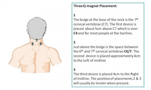 Magnetic therapy treatment for neck pain and frozen shoulder